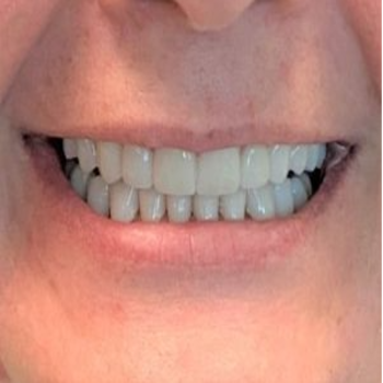 Dental-Service-Miami