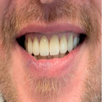 Dental-Service-Miami